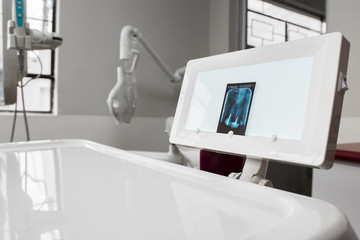 dentist machinery with a negatoscope showing an x-ray dental plaque on the screen