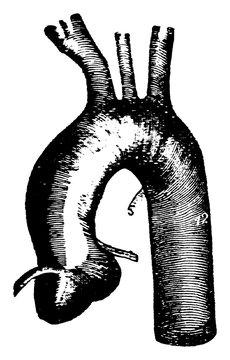 Thoracic Aorta, Vintage Illustration.