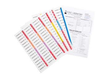 Lab virus blood test concept