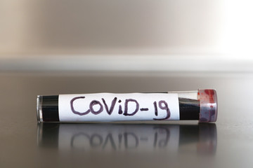 Test tube with blood of positive COVID-19 test and laboratory sample of blood testing for diagnosis new Corona virus infection.