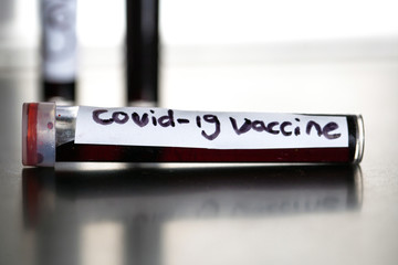 Blood sample of convid-19 vaccine, coronavirus covid-19 virus in the blood sample tube along with...
