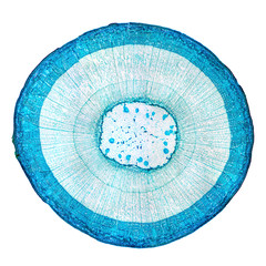 Stem of wood dicotyledon, whole cross section under microscope. Light microscope slide with the...