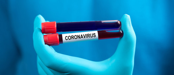 Coronavirus 2019-nCoV Blood Sample.