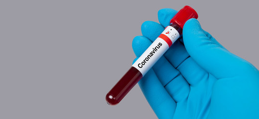 Coronavirus 2019-nCoV Blood Sample.