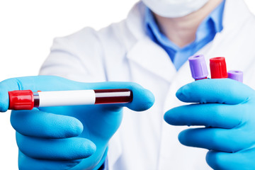 Coronavirus 2019-nCoV Blood Sample.