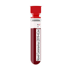 Microbiological blood test results show positive for Novel Coronavirus (2019-nCoV) vector illustration