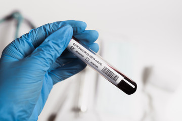 Coronavirus blood test. Doctor holding a test tube. 2019-nCoV. Covid.