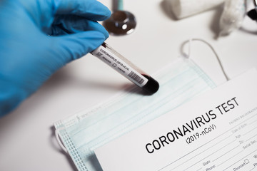 Coronavirus test, thermometer, pills, stethoscope,  laboratory desk. 2019-nCoV Coronavirus originating in Wuhan, China.