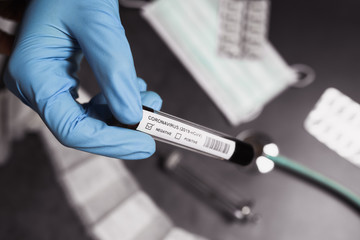 Coronavirus blood test positive. Doctor holding a test tube. 2019-nCoV. Covid.