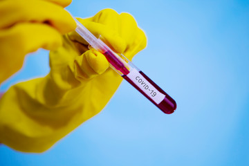 Coronavirus disease (COVID-19) blood sample in laboratory. Virus sample in laboratory. 