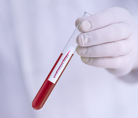 Coronavirus 2019-nCoV Sample. medical nurse holding test-tube. Epidemic disease