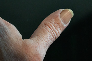 Hand, Finger