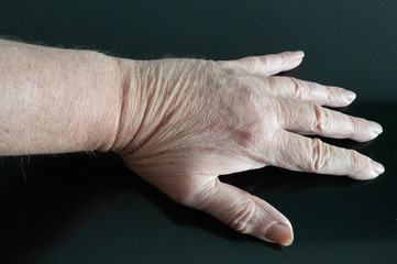 Hand, Finger
