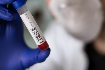 Fototapeta premium Blood sample for coronavirus covid - 19 disease analysis 