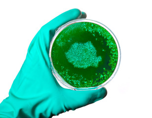 Germs in the shape of Romania in a petri dish.(series)