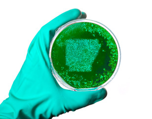 Germs in the shape of Arkansas in a petri dish.(series)