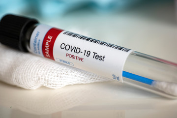 Testing for presence of coronavirus. Tube containing a swab sample that has tested positive for...