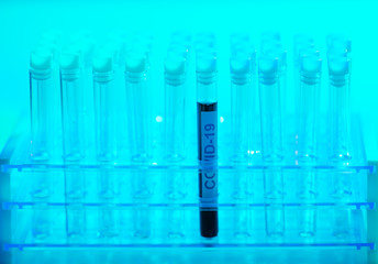 Laboratory tube with blood and virus. Scientific lab close-up. Pandemic disease, healthcare, vaccine research and coronavirus covid-19 test.
