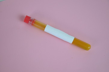 Colored liquids yellow in test tubes over pink background