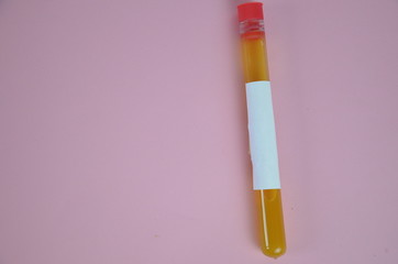 Colored liquids yellow in test tubes over pink background