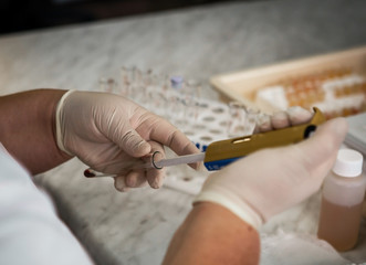 Laboratory tests for the presence of coronavirus COVID-19. Blood test in the hospital.