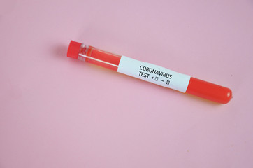Positive blood test result for the new rapidly spreading Coronavirus, originating in Wuhan, China
