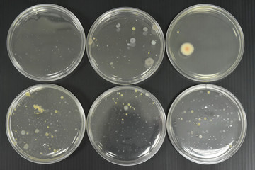 Colonies of bacteria in petri dish.