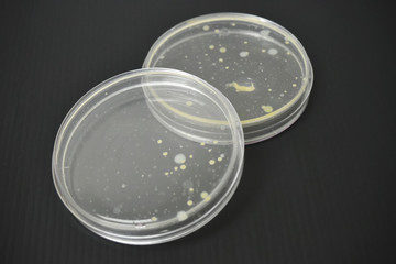 Colonies of bacteria in petri dish.