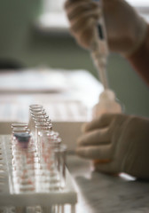 Laboratory tests for the presence of coronavirus COVID-19. Blood test in the hospital.