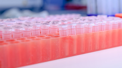 Laboratory rack with plastic tubes for DNA study. DNA gel-loading. Concept of science, laboratory and study of diseases.