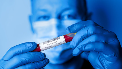 Man holds blood test tube for SARS-CoV-2 analysis. Chinese Corona Virus Blood Test Concept