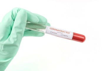 Obraz premium Hand holds a test tube containing a Coronavirus 2019-nCoV blood sample. Laboratory testing patient’s blood Covid-19 (coronavirus) analyzing. treatment of Covid-19. Novel Chinese virus