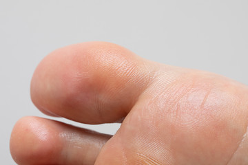 Extreme close-up of young adult human foot sole and big toe skin