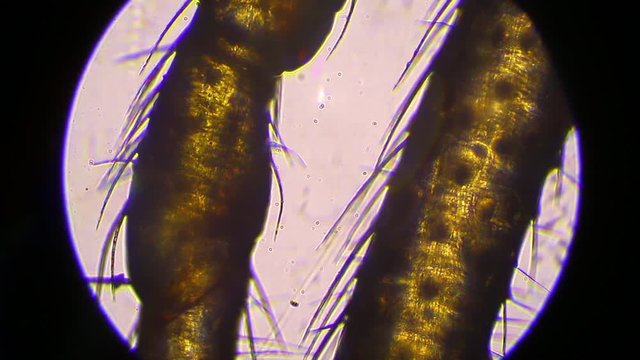 Spider legs under the microscope