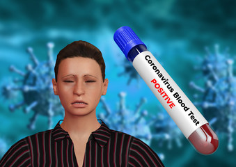 positive blood sample test for covid-19 disease caused by coronavirus. Viral pandemic worldwide