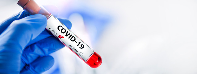 Doctor holding a positive blood test result for the new rapidly spreading Coronavirus.