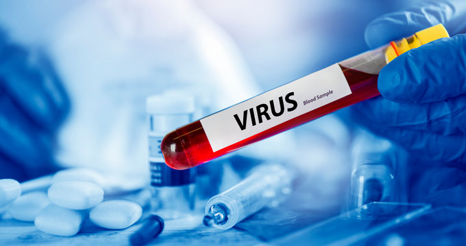 Coronavirus blood sample in blue glove hand with positive blood dangrous virus.