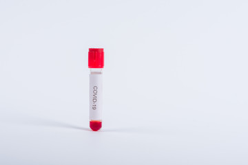 Test tube with blood infected with Coronavirus in chemical analysis laboratory on white background. (Covid-19)