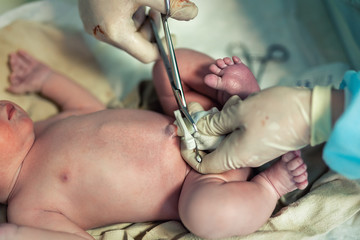 Close-up doctor obstetrician nurse cutting umbilical cord with medical scissors to newborn infant...