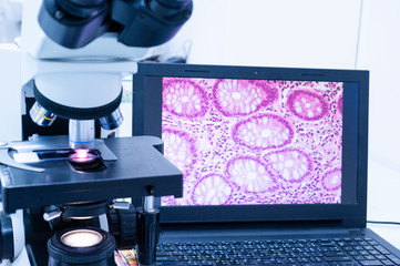 Modern microscope and human tissue section slide with computer monitor show glandular image.Medical...
