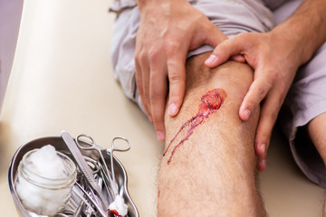 Leg injured man visiting old doctor in first aid concept