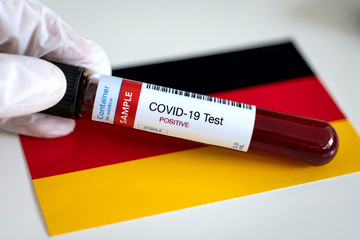 Fototapeta premium Testing for presence of coronavirus. Tube containing a blood sample that has tested positive for COVID-19. Flag of the Germany in the background.