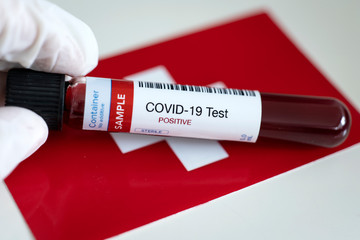 Obraz premium Testing for presence of coronavirus. Tube containing a blood sample that has tested positive for COVID-19. Flag of Switzerland in the background.