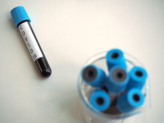 Test tube with blood sample for COVID-19 test in medical laboratories or chemistry...