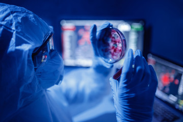 Microbiology hand medical working on agar plate culture bacteria and drug resistance of pathogens...
