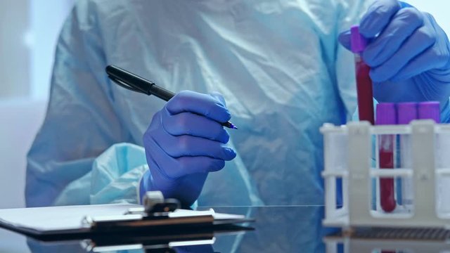 SARS epidemic. Laboratory test. Doctor in gloves marking blood samples in tubes.