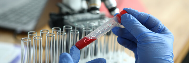 Male chemist hand in blue protective gloves hold test tube closeup background