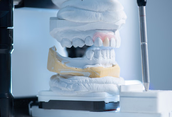 Zahnersatz in der Zahnarztpraxis, Anwendung und Programmierung mit Hilfe des Artikulator
