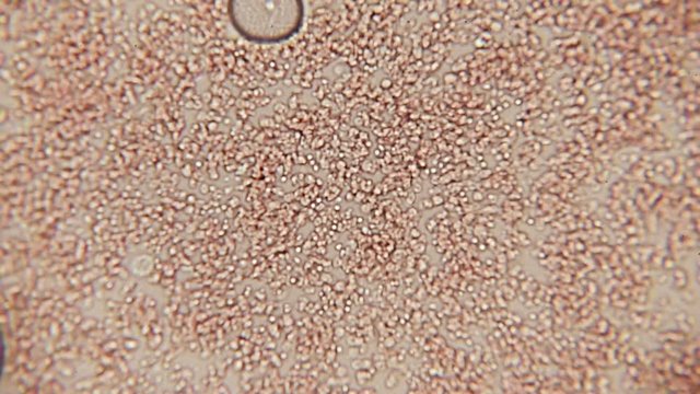 Blood Cell Channel 100x (HD 60p). Blood Platelets seen forming a small pathway at 100x magnification with the aid of a halogen bacteriological microscope.