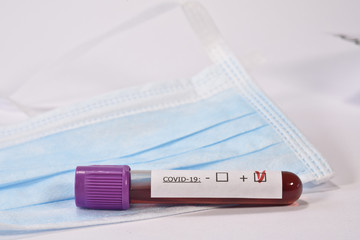 coronavirus covid-19 virus epidémie analyse test